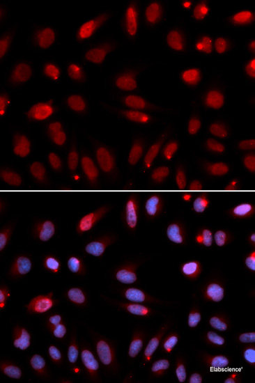 Immunohistochemistry of paraffin-embedded Rat kidney using PGRMC1 Polyclonal Antibody at dilution of 1:100 (40x lens).