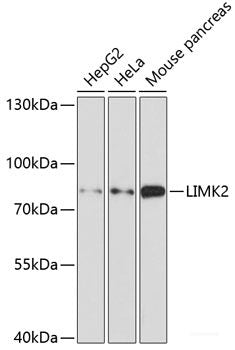 Western blot analysis of extracts of Mouse liver using C9 Polyclonal Antibody at dilution of 1:1000.