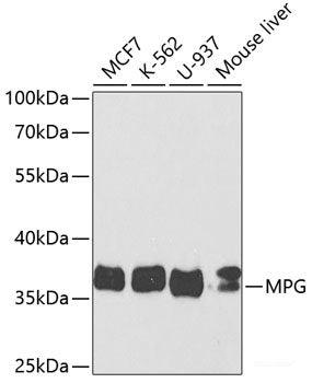 Immunofluorescence analysis of Human placenta using CFI Polyclonal Antibody at dilution of 1:100. Blue: DAPI for nuclear staining.