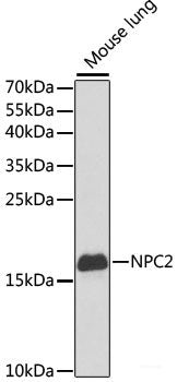 Immunohistochemistry of paraffin-embedded Human prostate using GNRH1 Polyclonal Antibody at dilution of 1:100 (40x lens).