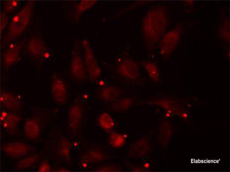 Western blot analysis of extracts of various cell lines using TPP1 Polyclonal Antibody at dilution of 1:1000.