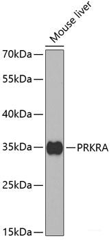 Immunohistochemistry of paraffin-embedded Human lung using APOC1 Polyclonal Antibody at dilution of 1:100 (40x lens).