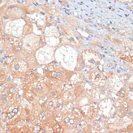 Immunofluorescence analysis of HeLa cells using ERCC2 Polyclonal Antibody