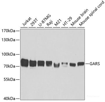 Immunofluorescence analysis of NIH/3T3 cells using FGG Polyclonal Antibody at dilution of 1:100. Blue: DAPI for nuclear staining.