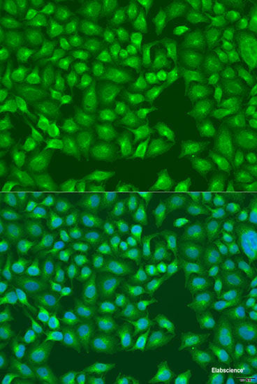 Immunohistochemistry of paraffin-embedded Human liver damage using IL4 Polyclonal Antibody at dilution of 1:100 (40x lens).