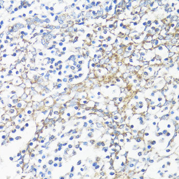 Immunofluorescence analysis of U2OS cells using SMAD4 Polyclonal Antibody