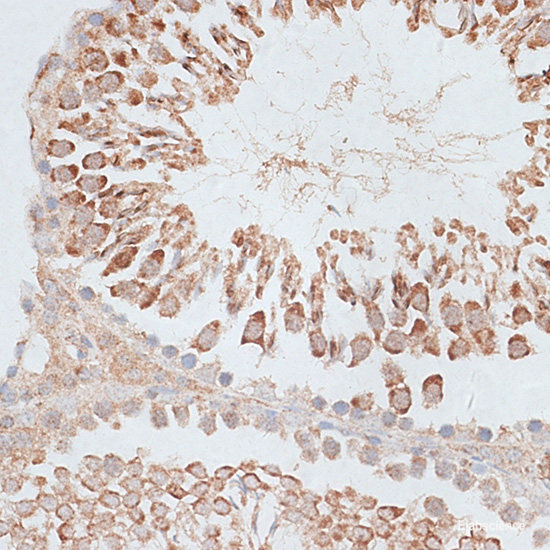 Immunohistochemistry of paraffin-embedded Rat brain using TNFSF12 Polyclonal Antibody at dilution of 1:100 (20x lens).