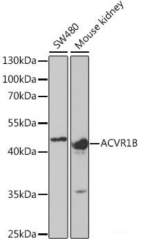 Western blot analysis of extracts of various cell lines using EPO Polyclonal Antibody at dilution of 1:500.