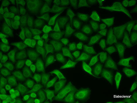 Western blot analysis of extracts of various cell lines using IL3 Polyclonal Antibody at dilution of 1:1000.