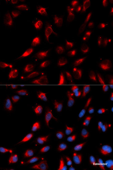 Immunohistochemistry of paraffin-embedded Rat kidney using KITLG Polyclonal Antibody at dilution of 1:200 (40x lens).