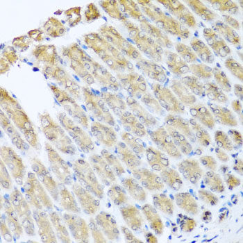 Immunohistochemistry of paraffin-embedded Rat brain using RBPJ Polyclonal Antibody at dilution of 1:100 (40x lens).