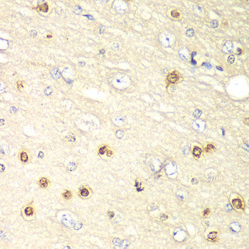 Immunohistochemistry of paraffin-embedded Human placenta using IQGAP1 Polyclonal Antibody at dilution of 1:200 (40x lens).
