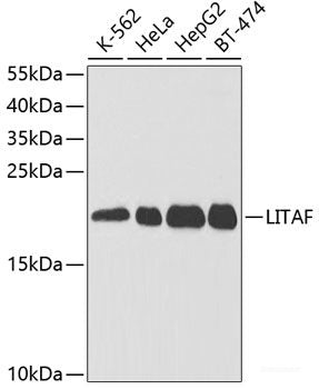 Western blot analysis of extracts of A-549 cells using TET2 Polyclonal Antibody at dilution of 1:1000.