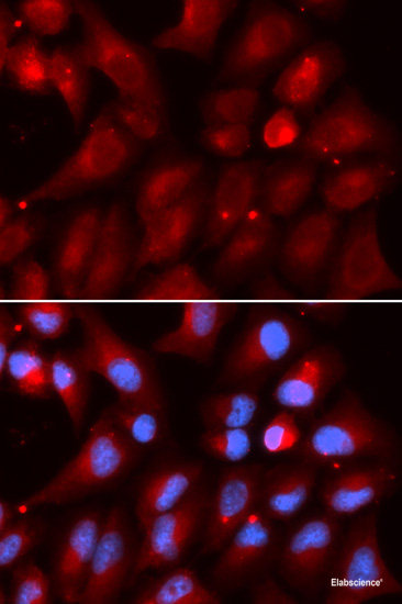 Western blot analysis of extracts of various cell lines using GSTP1 Polyclonal Antibody at dilution of 1:1000.