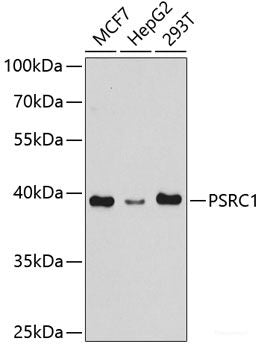 Western blot analysis of extracts from normal (control) and HPRT1 knockout (KO) 293T cells using HPRT1 Polyclonal Antibody at dilution of 1:1000.
