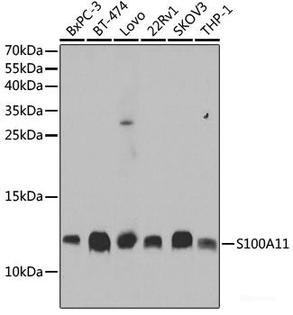 Immunofluorescence analysis of HeLa cells using SH3GL2 Polyclonal Antibody