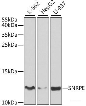 Immunohistochemistry of paraffin-embedded Rat brain using TP53BP2 Polyclonal Antibody at dilution of 1:100 (40x lens).