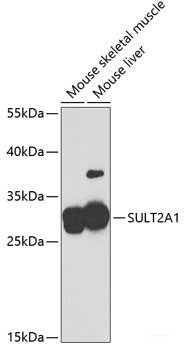 Immunohistochemistry of paraffin-embedded Rat brain using ZEB2 Polyclonal Antibody at dilution of 1:100 (40x lens).
