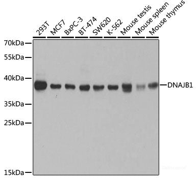 Immunohistochemistry of paraffin-embedded Human stomach using RUVBL1 Polyclonal Antibody at dilution of 1:100 (40x lens).