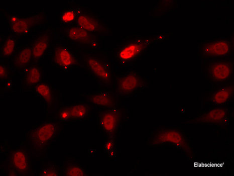 Western blot analysis of extracts of various cell lines using Caspase-2 Polyclonal Antibody at dilution of 1:1000. Jurkat cells were treated by Staurosporine(1uM) at room tempeRature for 3 hours.