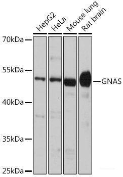 Western blot analysis of extracts of various cell lines using ACTR2 Polyclonal Antibody at dilution of 1:1000.
