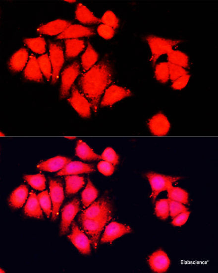 Immunohistochemistry of paraffin-embedded Human spleen using CD14 Polyclonal Antibody at dilution of 1:100 (40x lens).