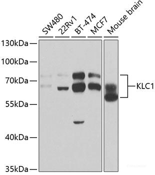 Immunofluorescence analysis of U2OS cells using PSMA5 Polyclonal Antibody
