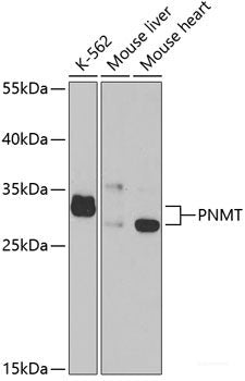 Western blot analysis of extracts of LO2 cells using CD155/PVR Polyclonal Antibody at dilution of 1:1000.