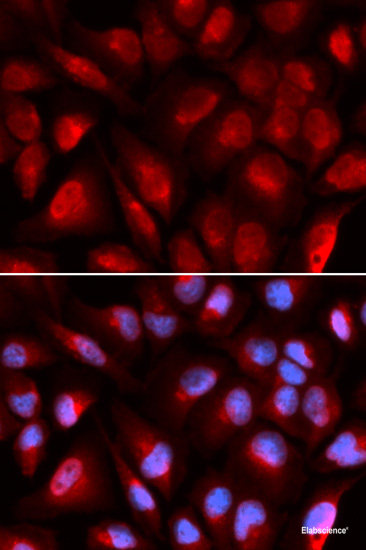Immunofluorescence analysis of U2OS cells using TCN2 Polyclonal Antibody
