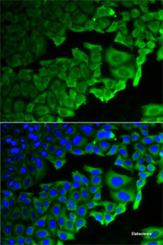 Western blot analysis of extracts of A-431 cells using 53BP1 Polyclonal Antibody at dilution of 1:1000.