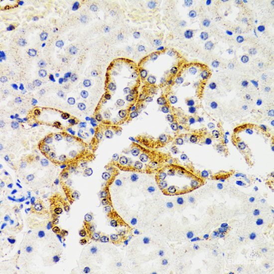 Immunohistochemistry of paraffin-embedded Rat ovary using p53 Polyclonal Antibody at dilution of 1:100 (40x lens).