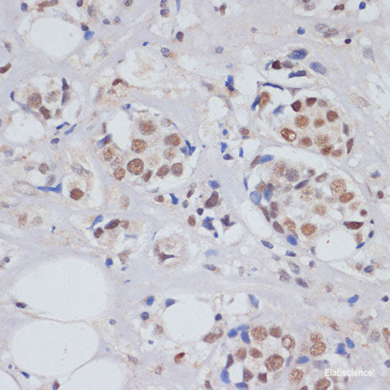 Immunofluorescence analysis of U2OS cells using CDKAL1 Polyclonal Antibody