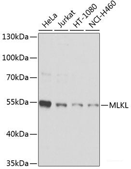 Immunohistochemistry of paraffin-embedded Rat brain using HEXIM1 Polyclonal Antibody at dilution of 1:100 (40x lens).