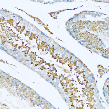 Immunohistochemistry of paraffin-embedded Human stomach using BAG5 Polyclonal Antibody at dilution of 1:100 (40x lens).