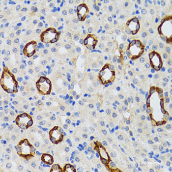 Immunohistochemistry of paraffin-embedded Rat lung using DEDD Polyclonal Antibody at dilution of 1:100 (40x lens).