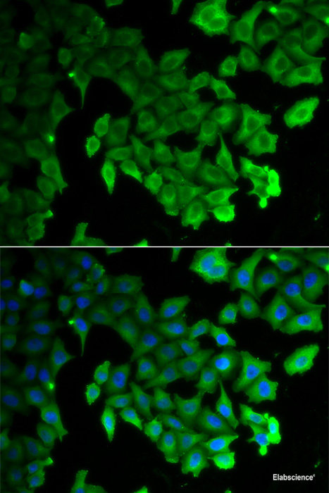 Immunofluorescence analysis of U2OS cells using EPC1 Polyclonal Antibody