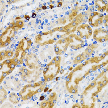 Immunohistochemistry of paraffin-embedded Mouse lung using ATG3 Polyclonal Antibody at dilution of 1:200 (40x lens).