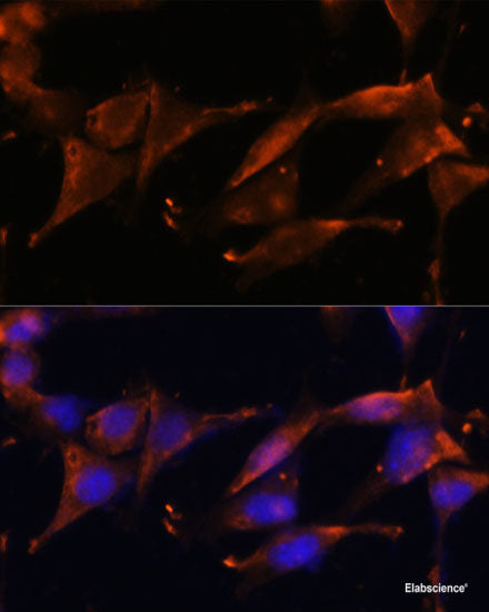 Immunofluorescence analysis of A549 cells using ING3 Polyclonal Antibody