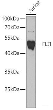Immunohistochemistry of paraffin-embedded Human liver damage using PRODH Polyclonal Antibody at dilution of 1:100 (40x lens).
