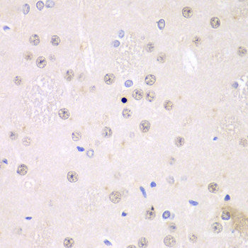 Immunohistochemistry of paraffin-embedded Mouse lung using RHOT1 Polyclonal Antibody at dilution of 1:100 (40x lens).