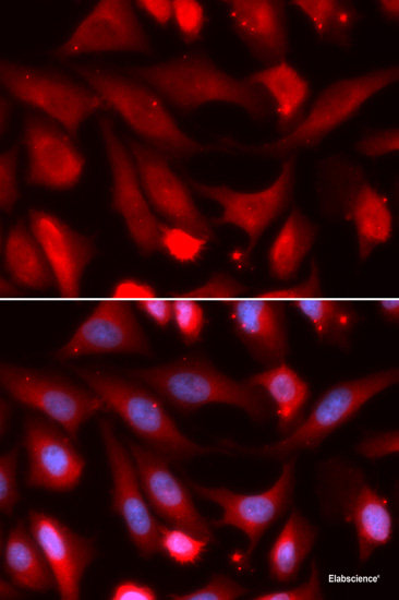 Immunofluorescence analysis of A431 cells using PRKCB Polyclonal Antibody at dilution of 1:100. Blue: DAPI for nuclear staining.