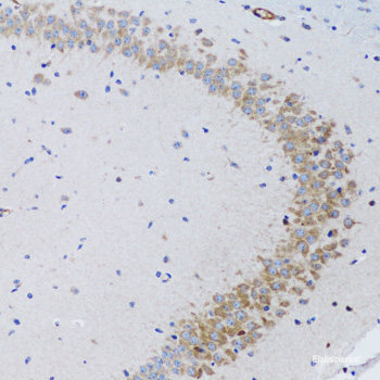 Immunofluorescence analysis of U2OS cells using PTH Polyclonal Antibody