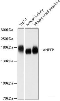 Western blot analysis of extracts of various cell lines using RTN4R Polyclonal Antibody at dilution of 1:1000.