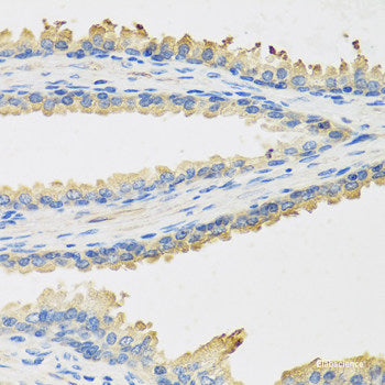 Immunofluorescence analysis of HeLa cells using NPRL2 Polyclonal Antibody