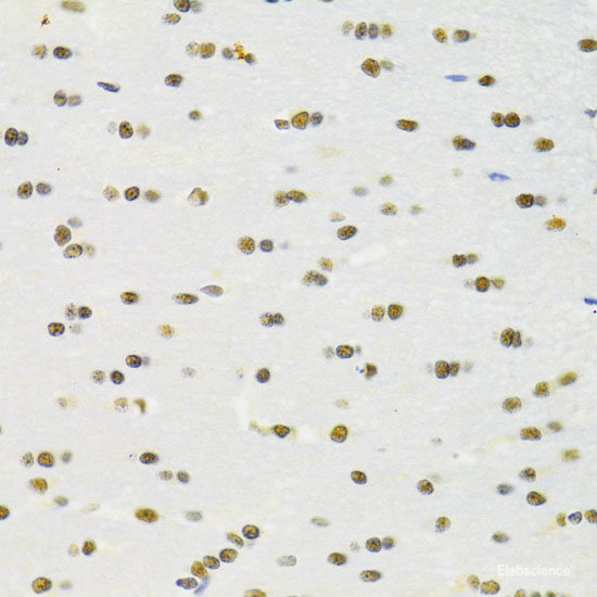 Western blot analysis of extracts of SKOV3 cells using WNT2 Polyclonal Antibody at dilution of 1:1000.