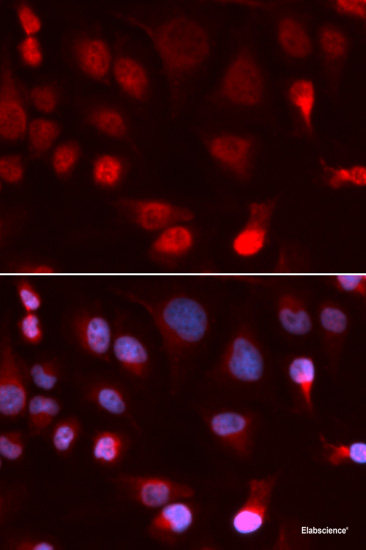 Western blot analysis of extracts of various cell lines using TFRC Polyclonal Antibody at dilution of 1:3000.