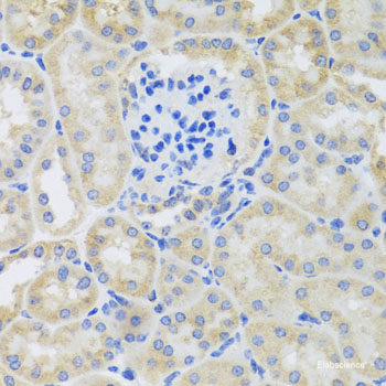 Immunofluorescence analysis of U2OS cells using APOBEC3C Polyclonal Antibody