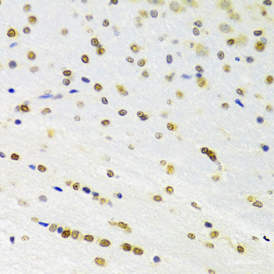 Immunohistochemistry of paraffin-embedded Rat heart using HNRNPR Polyclonal Antibody at dilution of 1:100 (40x lens).