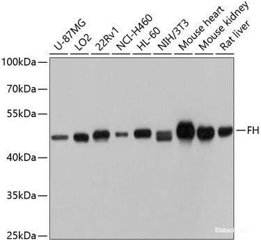 Western blot analysis of extracts of various cell lines using RPS3A Polyclonal Antibody at dilution of 1:1000.
