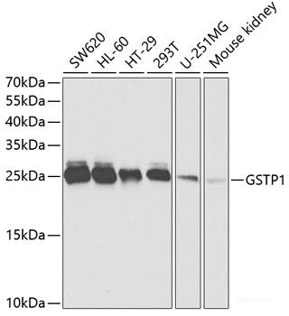 Immunofluorescence analysis of A549 cells using EIF5B Polyclonal Antibody